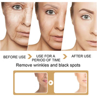 Turmeric Dark Spot Correction Face Care Spot Moisturizing And Repairing Skin Tone Serum - image 3
