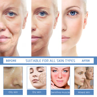 Jaysuing Anti-Aging Facial  Firming, Anti-Line Moisturizing & Anti-Aging - image 2
