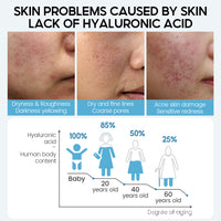 Hyaluronic Acid Moisturizing Face Serum - image 3