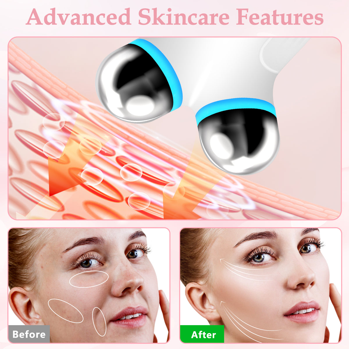 Microcurrent Facial Massager - White - image 3