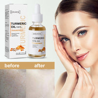 Turmeric Dark Spot Correction Face Care Spot Moisturizing And Repairing Skin Tone Serum - image 1