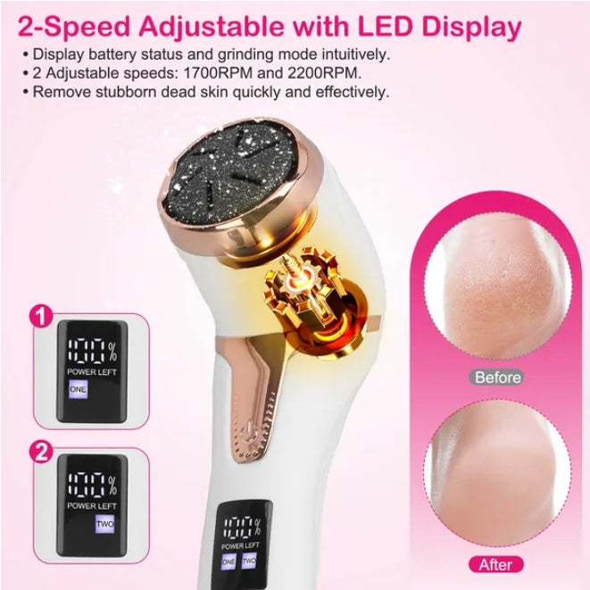 17-Piece Electric Foot File Set - image 3