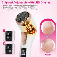 17-Piece Electric Foot File Set - image 3