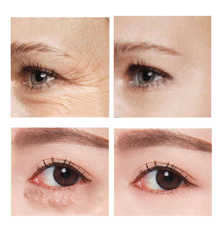 Hydrating Eye Cream 30ml - image 3